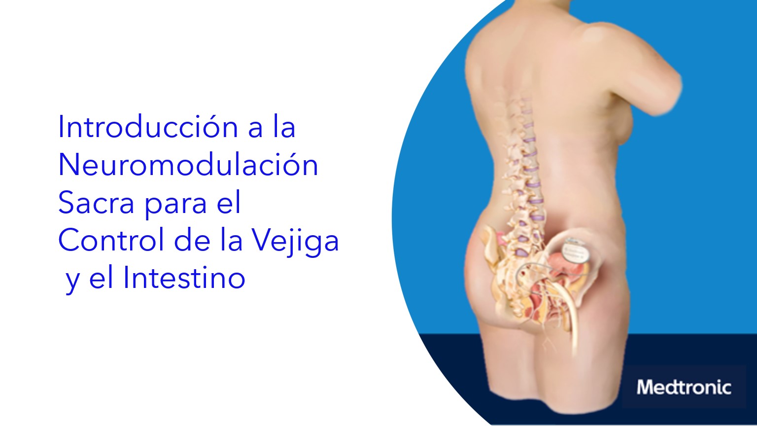 Neuromodulación Sacra – Mecanismo de Acción.