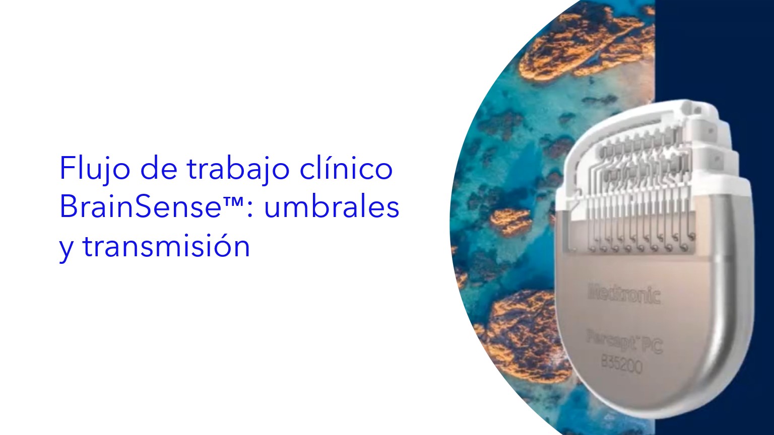 Flujo de trabajo clínico BrainSense™: umbrales y transmisión . |  Fluxo de trabalho clínico BrainSense™: limites e streaming .
