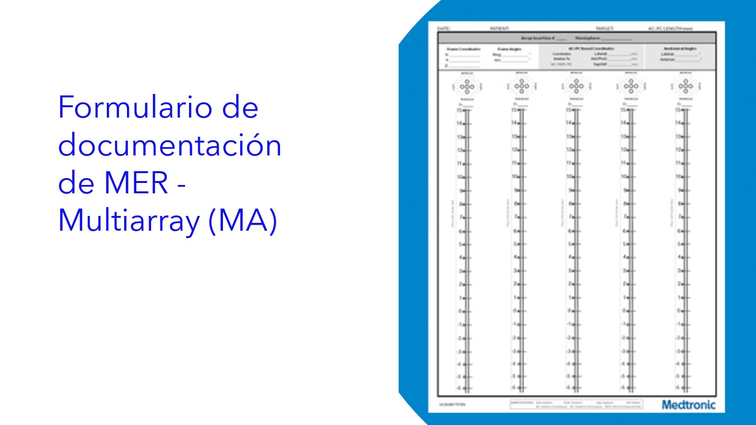 Formulario de documentación de MER - Multiarray (MA) | Formulário de documentação MER - Multiarray (MA) | MER Documentation Form - Multiarray (MA)