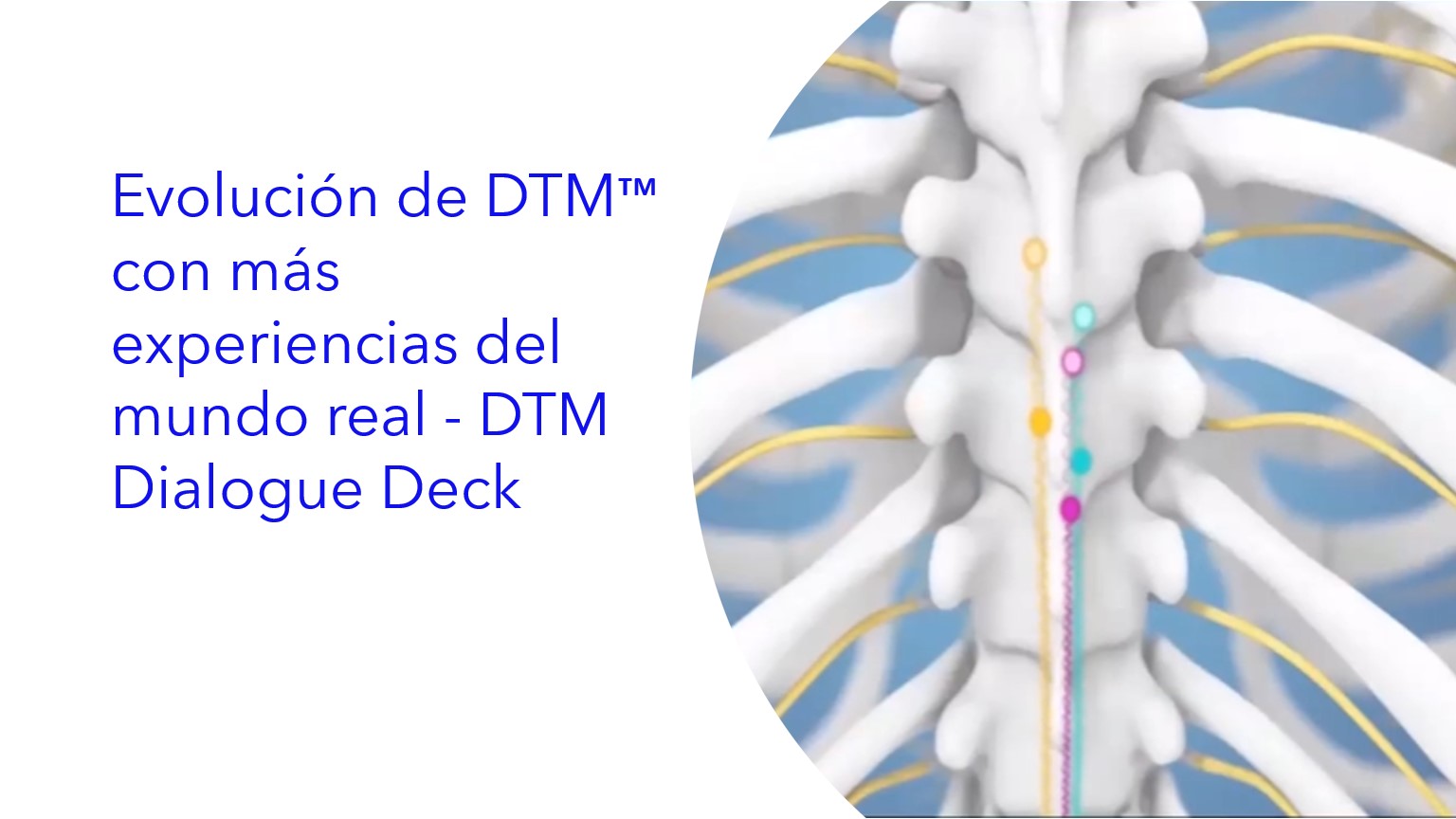 Evolución de DTM™ con más experiencias del mundo real - DTM Dialogue Deck